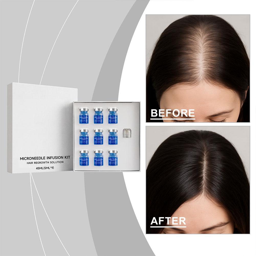 Hair Care Conditioner - 0.25mm Saç Esansiyel Serumu Mikro iğneli